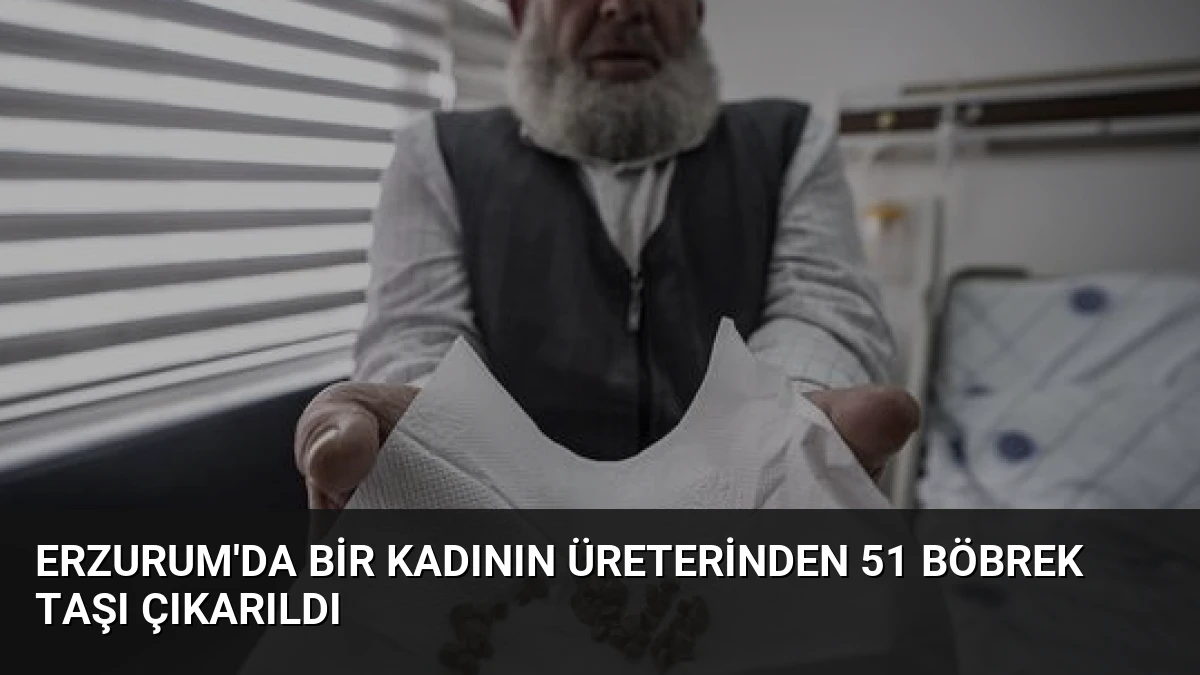 Erzurum’da Bir Kadının Üreterinden 51 Böbrek Taşı Çıkarıldı