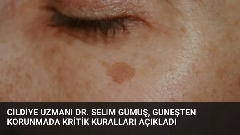 Cildiye Uzmanı Dr. Selim Gümüş, Güneşten Korunmada Kritik Kuralları Açıkladı